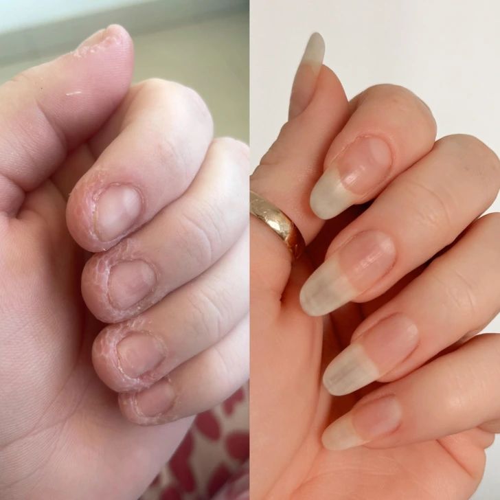 Before and After Nails